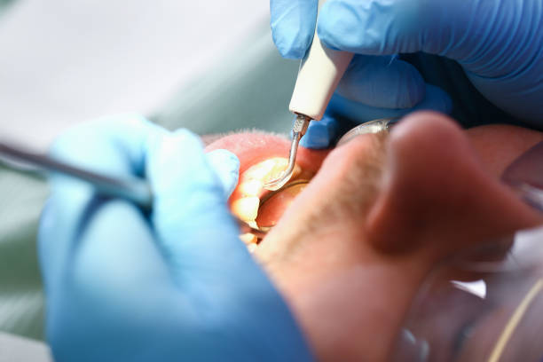 Best Dentist Open Late Near Me  in Detroit Beach, MI